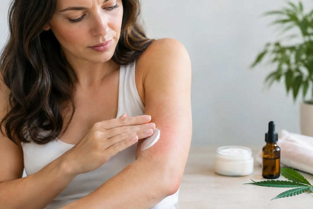 Can CBD Lotion Cause Irritation? What to Know
